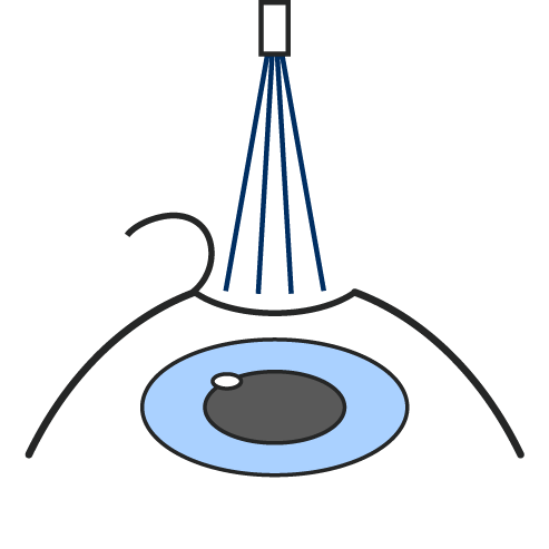 Icon Augenlaserung