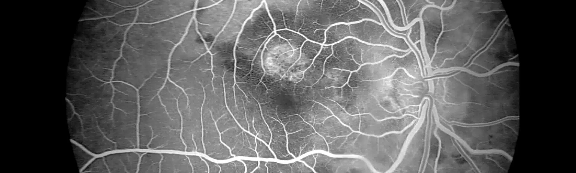 Vergrößerte Aufnahme Angiographie
