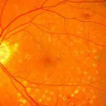 Therapeutische Laserbehandlung nachher